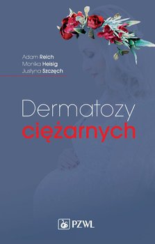 Dermatozy ciężarnych okładka